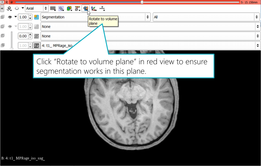 Visualizing Mri And Ct Scans In Mixed Reality Vr Ar Part 4